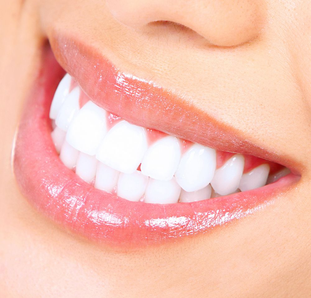 Best Teeth Whitening