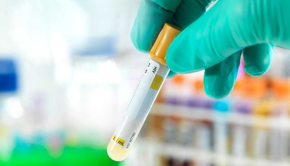 HIV testing & treatment